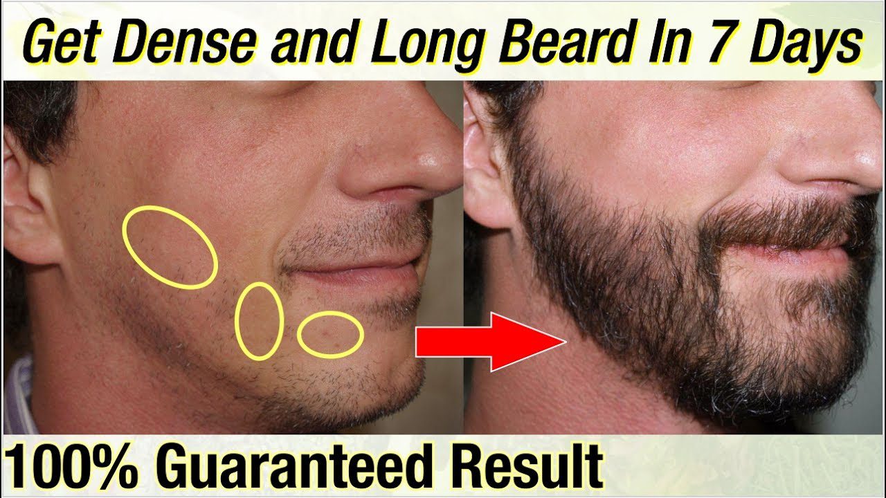 How To Grow Beard Faster & Get Rid Of Patchy Beard - Good Beard Day